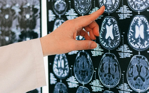 Thumbnail Berita - Penggunaan AI pada Mesin MRI Buat Diagnosis Lebih Cepat dan Akurat